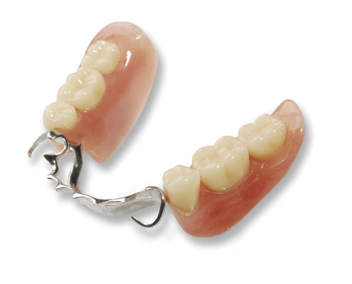 Protesi dentale per denti anteriori - Cast Partial  - Derby Dental - per denti posteriori