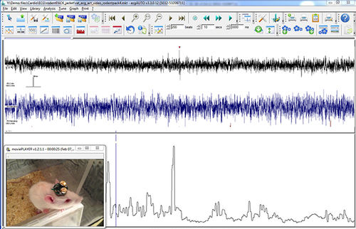 Software medico - EEG+ - emka TECHNOLOGIES - per EMG / cardiovascolare / neurologico
