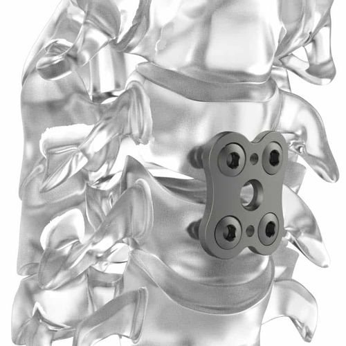 Placca per artrodesi cervicale - PM BUTTERFLY® - NEURO FRANCE Implants - bloccata / in titanio / 2 livelli