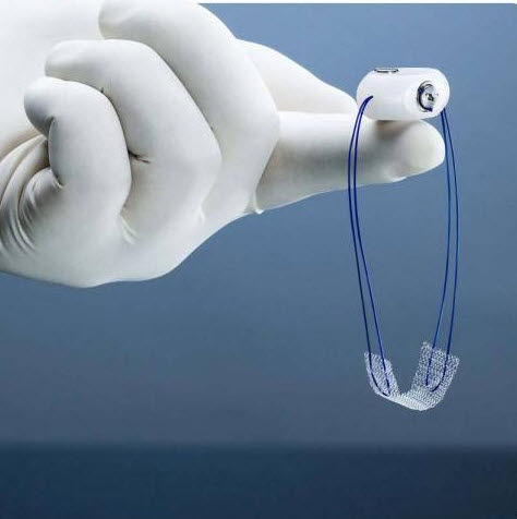 Fascetta per ricostruzione per l'incontinenza urinaria - Remeex - Neomedic International - via transvaginale / per donna