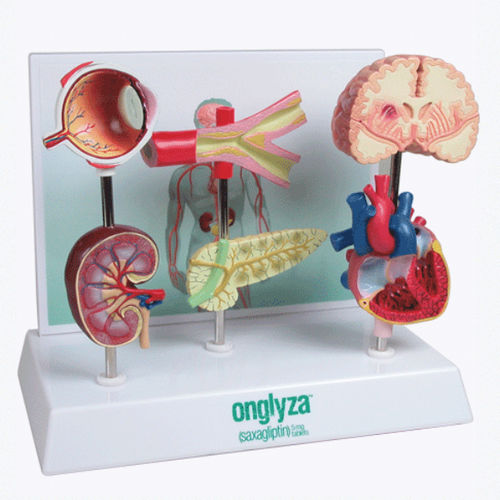 Modello anatomico del diabete - A575 - Apple Biomedical - di cuore / di arteria / di occhio