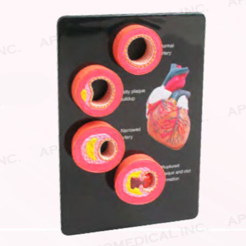Modello anatomico portatile - A534 - Apple Biomedical - di arteria / ad uso didattico / rosa