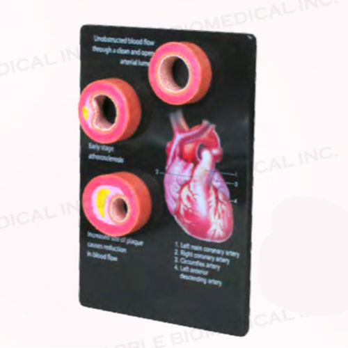 Modello anatomico di arteria - A520 - Apple Biomedical - ad uso didattico / rosa / portatile