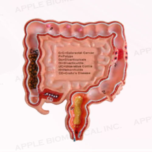 Modello anatomico di colon - A345 - Apple Biomedical - per gastroenterologia / ad uso didattico / rosa