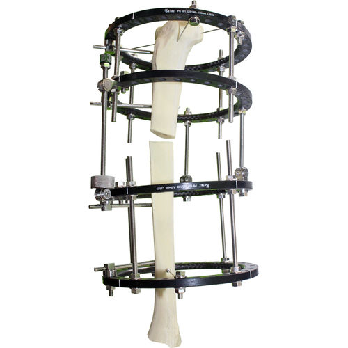 Fissatore esterno per tibia - pt-BR - Selaz - circolare / per adulti