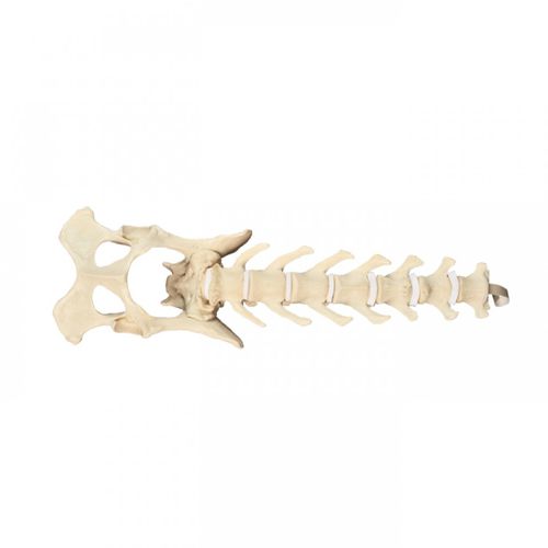 Modello anatomico di bacino - AV413 - Nacional Ossos - di colonna vertebrale lombare / per chirurgia / ad uso didattico