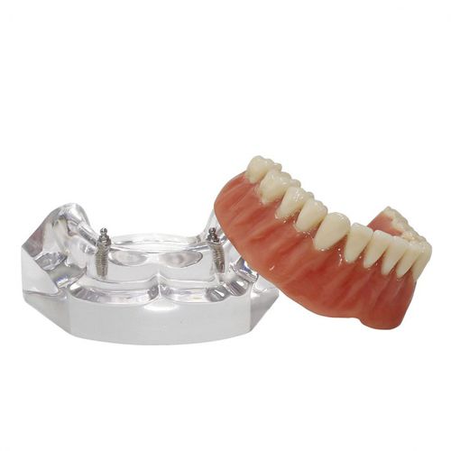 Modello anatomico di dentatura - 9566  - Nacional Ossos - per implantologia / per protesistica dentale / ad uso didattico