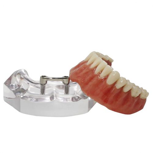 Modello anatomico di dentatura - 9567  - Nacional Ossos - per implantologia / per protesistica dentale / ad uso didattico