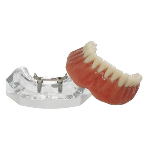 Modello anatomico di dentatura - 9565  - Nacional Ossos - per implantologia / per protesistica dentale / ad uso didattico