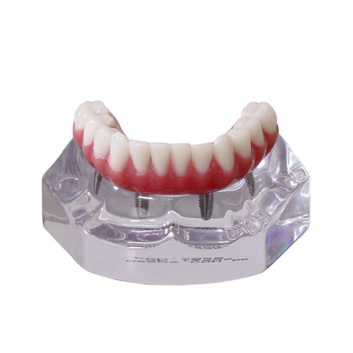 Modello anatomico di dentatura - 9568 - Nacional Ossos - per implantologia / per protesistica dentale / ad uso didattico