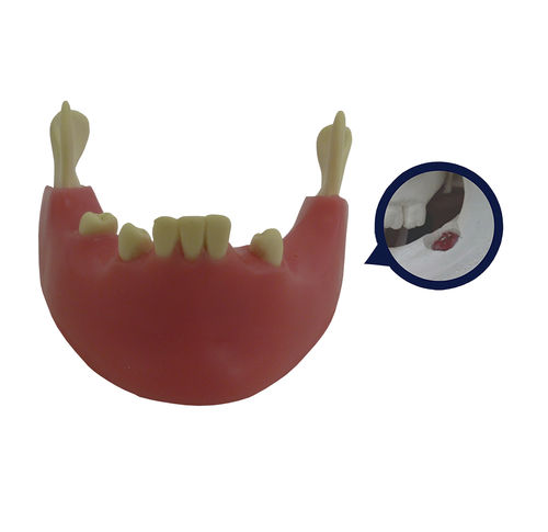 Modello anatomico di mandibola - 4401G-02 - Nacional Ossos - gengivale / per chirurgia / per estrazione dentale