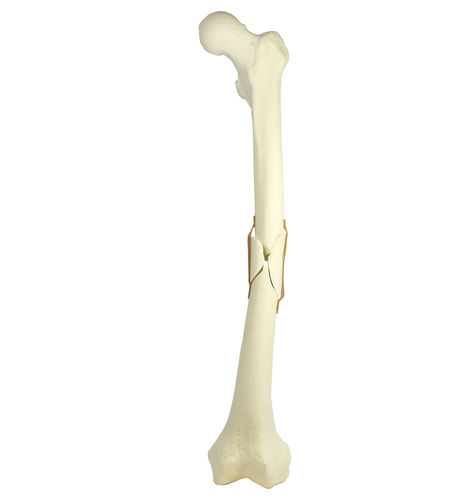 Modello anatomico osseo - 9703 - Nacional Ossos - di femore / per chirurgia ortopedica / didattico