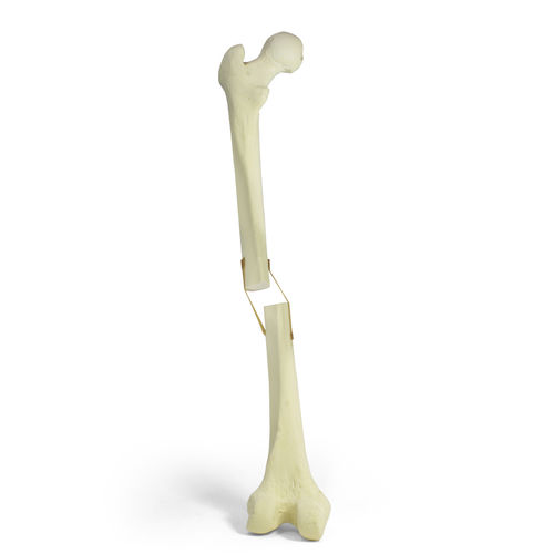 Modello anatomico osseo - 9702 - Nacional Ossos - di femore / per chirurgia ortopedica / didattico