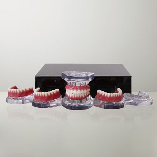 Modello anatomico di mandibola - 9768 - Nacional Ossos - di mascella / di dentatura / per cure odontoiatriche