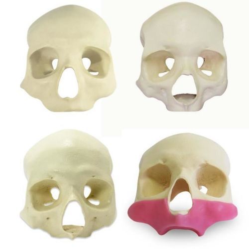 Modello anatomico di cranio - 9014G ALL-ON-4 - Nacional Ossos - di seno nasale / gengivale / per implantologia