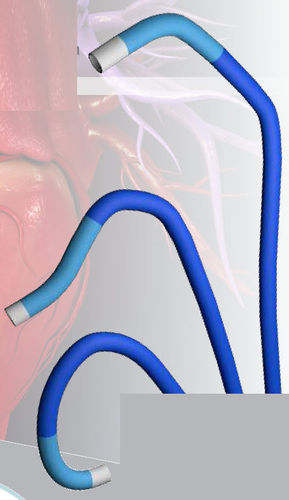 Catetere di guida - Tracer™  - MEDAS INC - cardiaco / 6 Fr / 7 Fr
