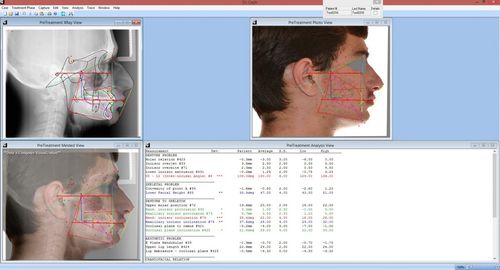 Software di analisi cefalometrica - Dr. Ceph - For Your Imaging Technologies - per diagnostica per immagini / ortodontico / chirurgico