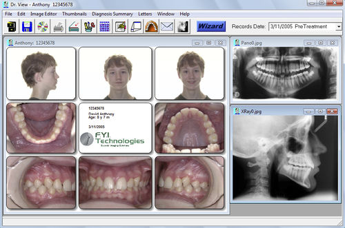 Software di analisi cefalometrica - Dr. View - For Your Imaging Technologies - ortodontico