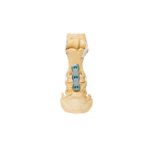 Placca ossea veterinaria per canidi - ALPS® PIP - KYON - generica / prossimale