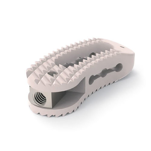 Gabbia intersomatica toraco-lombare - Twisty  - NORMMED Medical Devices - via transforaminale / in PEEK