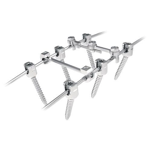 Sistema di osteosintesi toraco-lombare - Silver  - NORMMED Medical Devices - via posteriore / per adulti