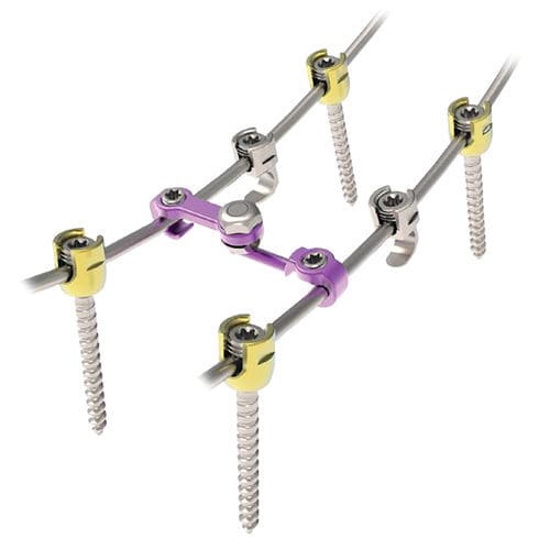 Sistema di osteosintesi toraco-lombare - Pedifix  - NORMMED Medical Devices - via posteriore / per adulti