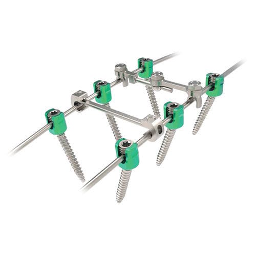 Sistema di osteosintesi toraco-lombare - Rapidfix  - NORMMED Medical Devices - via posteriore / per adulti