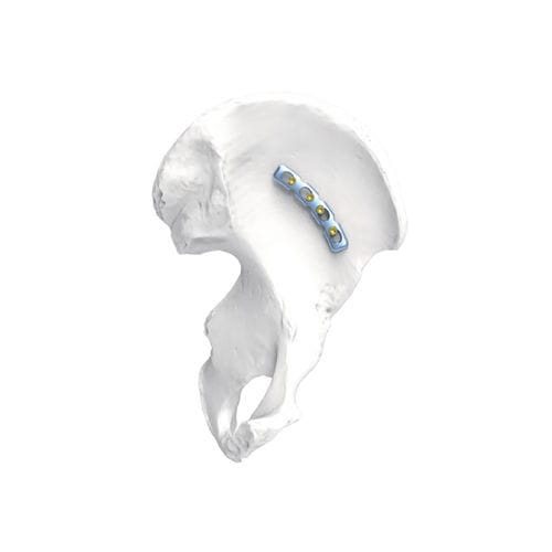 Placca di compressione per massiccio facciale - PNM1075 - NORMMED Medical Devices - bloccata / in metallo