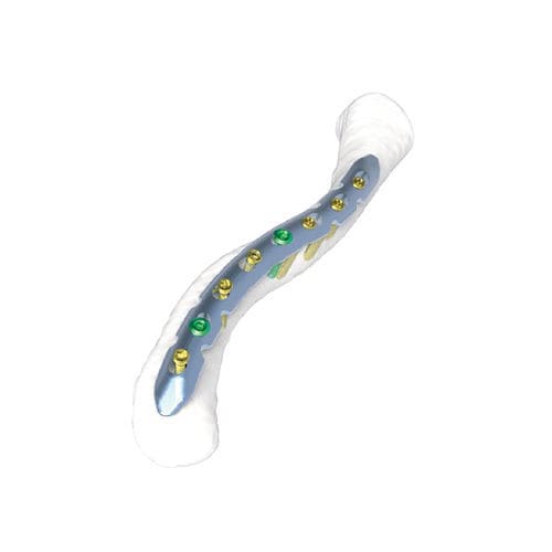 Placca di compressione per clavicola - PNM1002 - NORMMED Medical Devices - bloccata / in metallo