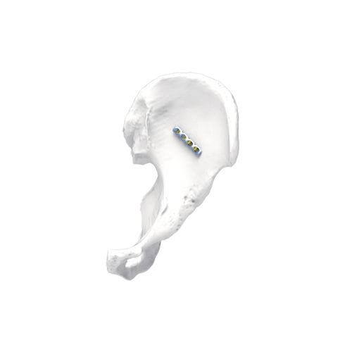 Placca di compressione per bacino - PNM1009 - NORMMED Medical Devices - bloccata / in metallo