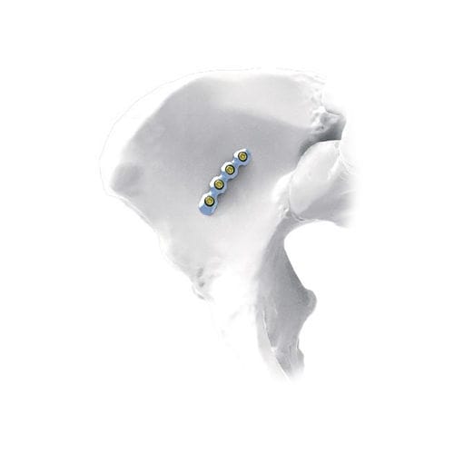 Placca di compressione per bacino - Curved  - NORMMED Medical Devices - bloccata / in metallo
