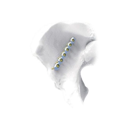 Placca di compressione per bacino - Straight - NORMMED Medical Devices - bloccata / in metallo