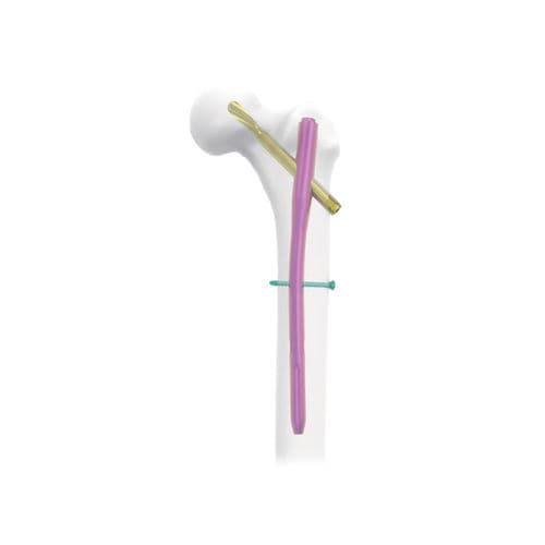 Chiodo intramidollare per femore - NORMMED Medical Devices - per trocantere / in metallo