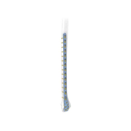 Placca di compressione per fibula - PNM1016 - NORMMED Medical Devices - distale / laterale / bloccata