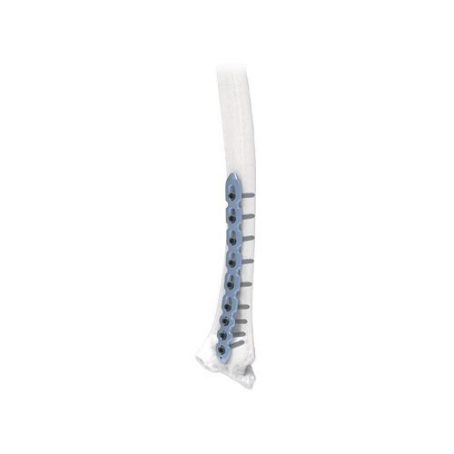 Vite per compressione ossea per radio - NORMMED Medical Devices - in metallo