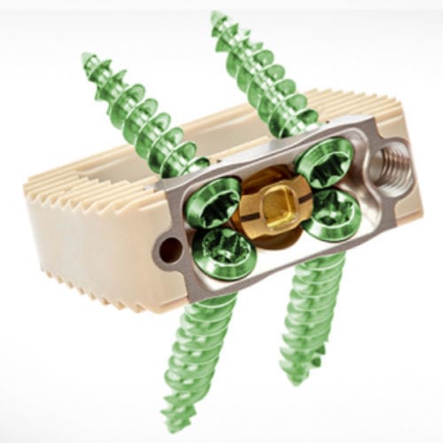 Gabbia intersomatica lombare - Spineology - via anteriore / in PEEK