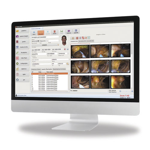 Software medico - Zscan HD - Zscan software - per diagnostica per immagini / per endoscopia / ORL