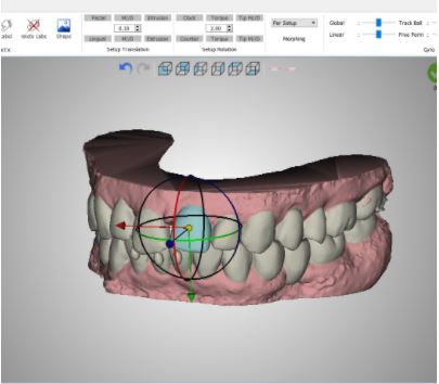 Software ortodontico - PLAN - VERSION 5.0 - Orchestrate Orthodontic Technologies - di controllo / di progettazione / Windows