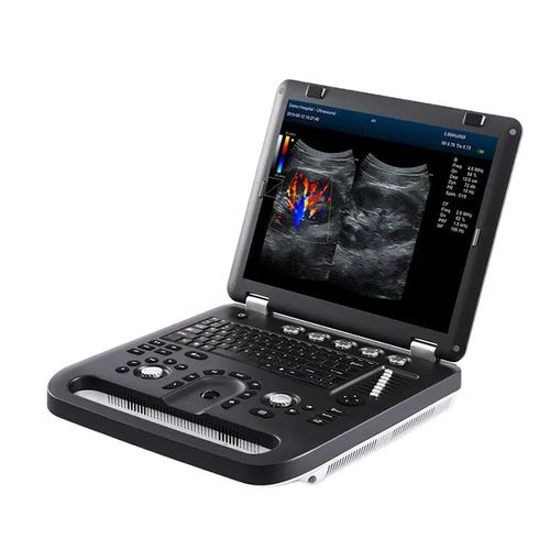 Ecografo portatile - M60  - Hunan Fude Technology - per ecografia multidisciplinare / in bianco e nero / con doppler a colori