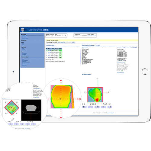 Modulo software per radioterapia - MU2net - DOSIsoft - di pianificazione del trattamento