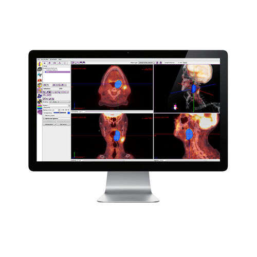 Software per radioterapia - IMAgo - DOSIsoft - di rilevamento dei contorni