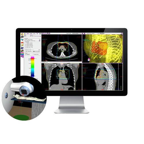 Software per radioterapia - SIMAgo - DOSIsoft - di simulazione