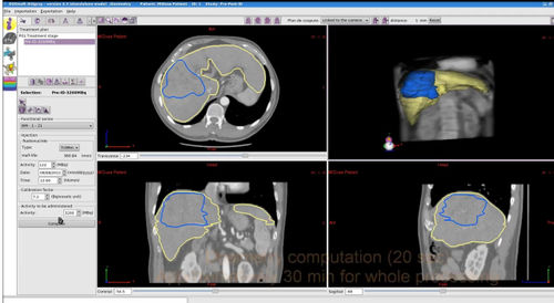 Software per radioterapia - PLANET® Dose - DOSIsoft - di calibrazione di dosi / di validazione