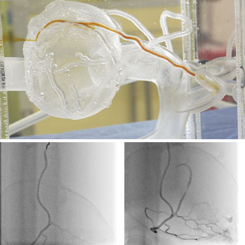 Modello anatomico di arterie coronarie - CABG Bypas - JMC Corporation - per bypass coronarico / trasparente