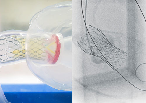 Modello anatomico di valvola aortica - TAVI  - JMC Corporation - per valvuloplastica