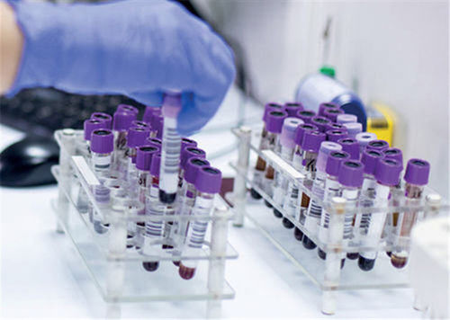 LIMS per reportistica - TDNexLabs - TECHNIDATA - di analisi / di gestione / di validazione