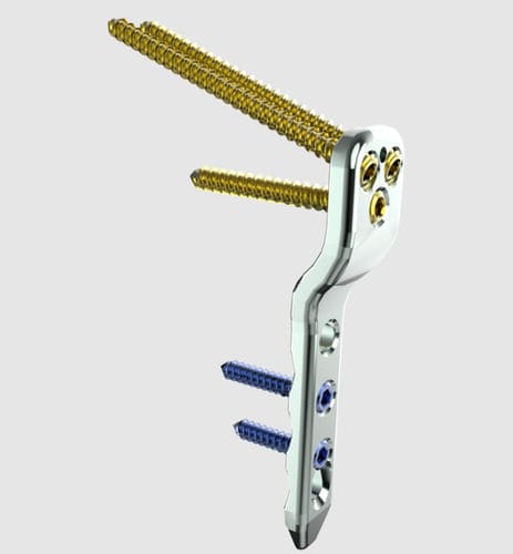 Placca per osteotomia per femore - 31610 series - Peditst - prossimale / bloccata / in acciaio inossidabile