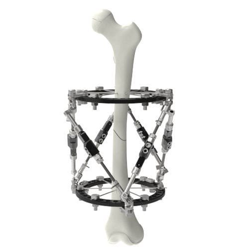Fissatore esterno per femore - Ortho-SUV® - Peditst - circolare / pediatrico