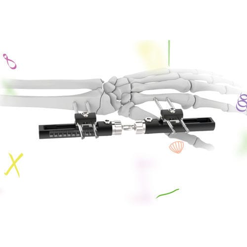Fissatore esterno per polso - WristX  - Peditst - tubolare / pediatrico