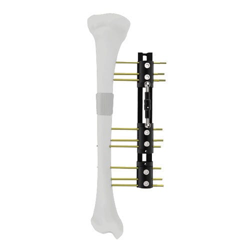 Fissatore esterno per tibia - LRS - Peditst - per femore / tubolare / pediatrico